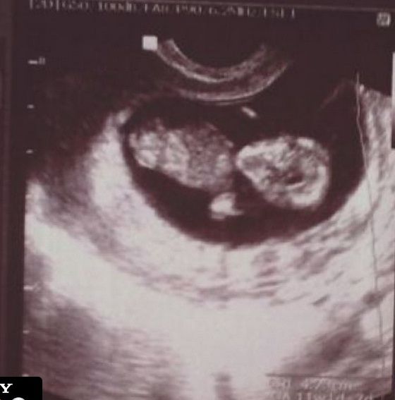  foto ExchicaGeneracionesCruzadasseconvertiraacuteenabuela_zpsfa089769.jpg